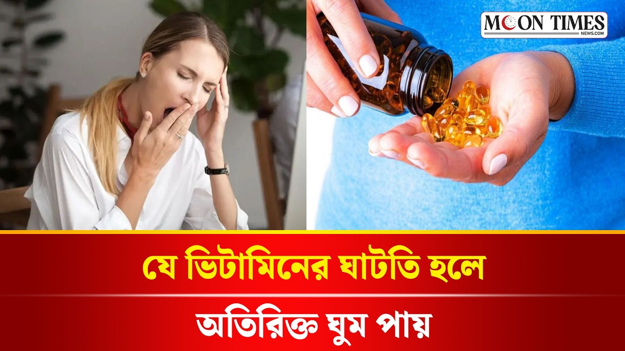 সারাদিন ঘুম ঘুম ভাব? এই ভিটামিনের অভাবে এমন হচ্ছে না তো? | Vitamin B12 Deficiency Sleepy